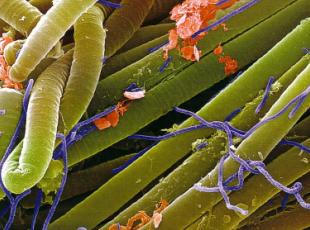 Электроннная фотография простейших синезеленых водорослей
